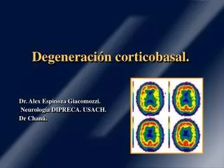 Degeneración corticobasal.