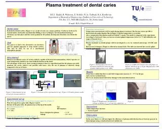 P lasma treatment of dental caries
