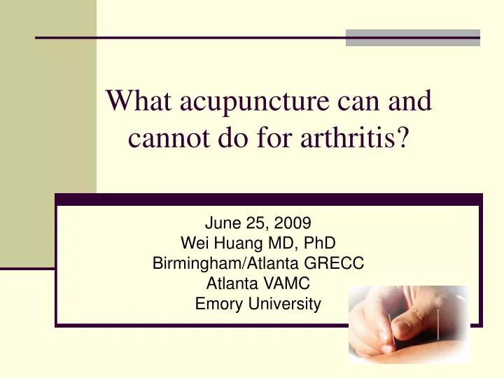 what acupuncture can and cannot do for arthritis