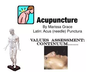 By Marissa Grace Latin: Acus (needle) Punctura Values Assessment: Continuum…….