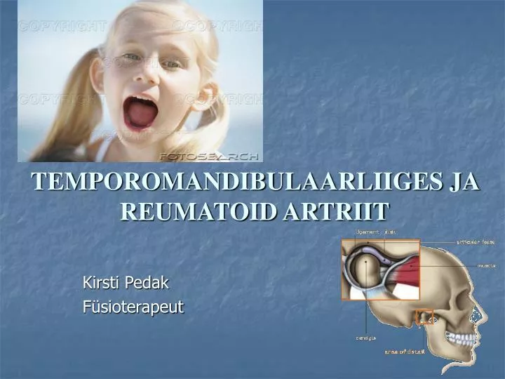 temporomandibulaarliiges ja reumatoid artriit