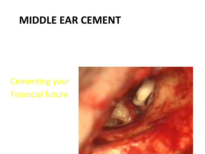 middle ear cement
