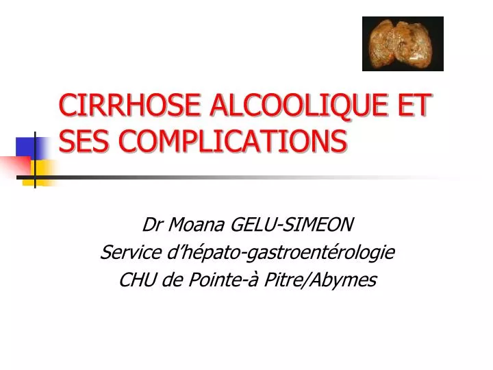 Ppt La Cirrhose Et Ses Complications Powerpoint Presentation Free The