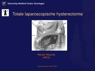 Totale laparoscopische hysterectomie