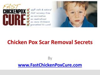 Chicken Pox Scar Removal Secrets