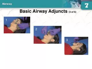 Basic Airway Adjuncts (3 of 6)