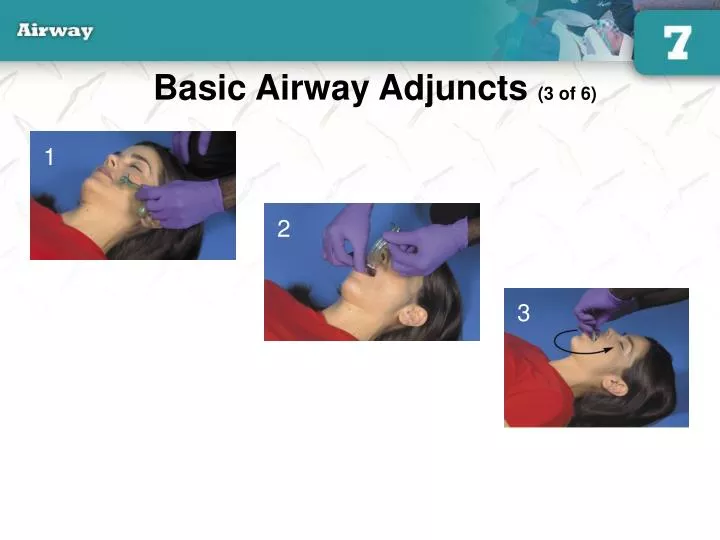 basic airway adjuncts 3 of 6