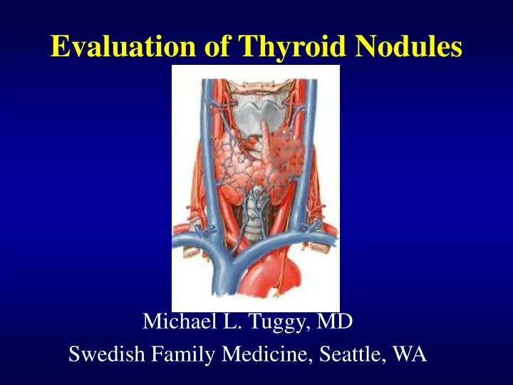 evaluation of thyroid nodules