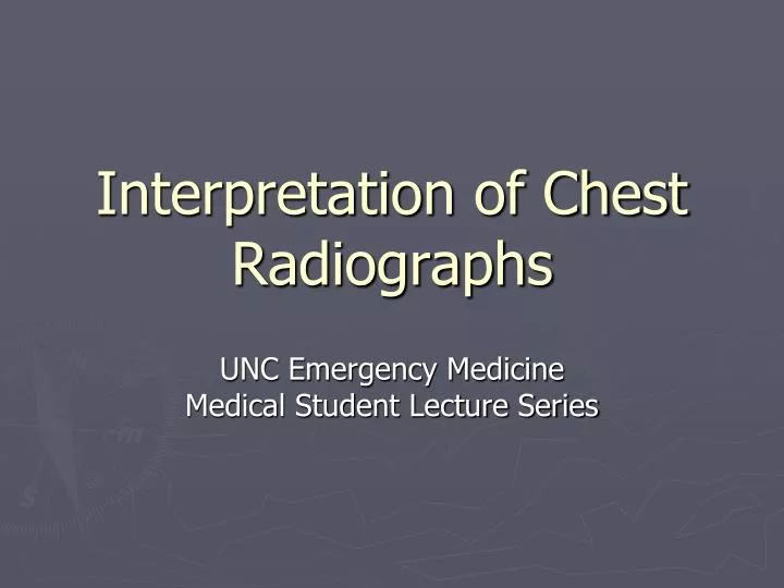 interpretation of chest radiographs