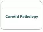 Carotid Pathology - slide 1