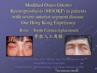 Ben Lam, Srinivas Rao, Alvin Young, Lulu Cheng,Dennis Lam Hong Kong Eye Hospital Department of Ophthalmology and vi