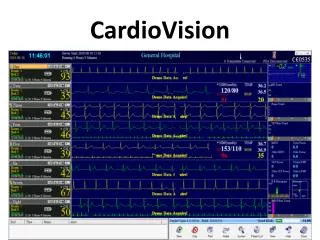 CardioVision