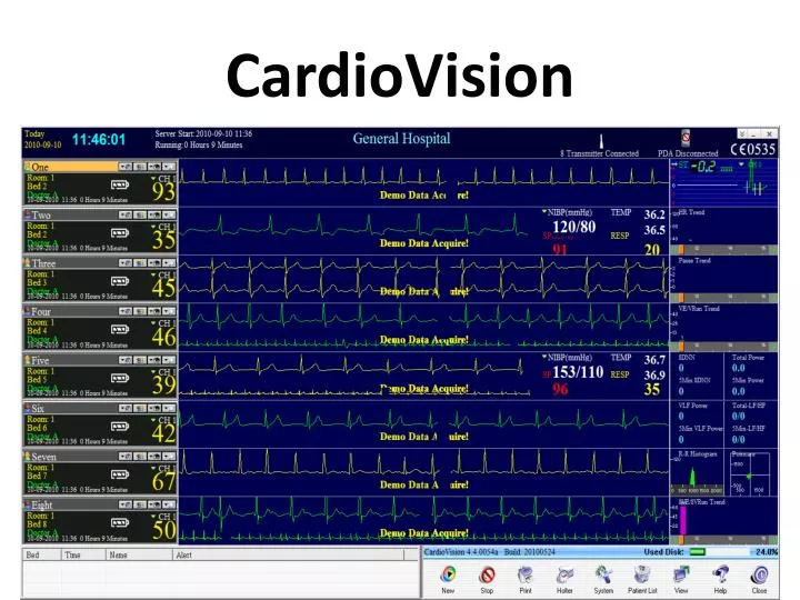 cardiovision