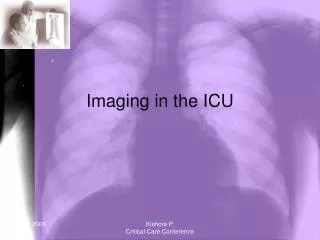 Imaging in the ICU