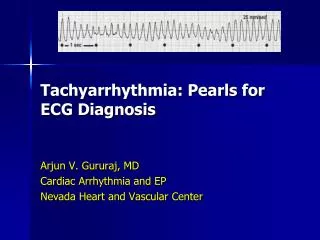 Tachyarrhythmia: Pearls for ECG Diagnosis