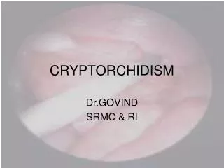 CRYPTORCHIDISM