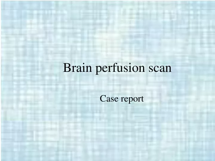 brain perfusion scan