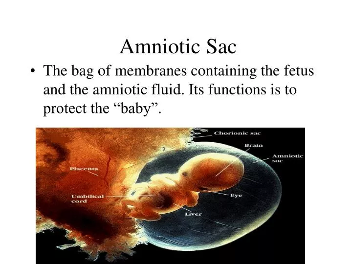 How common is it for babies to be born within the amniotic sac and it still  be intact? - Quora