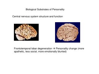 Biological Substrates of Personality