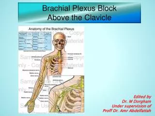 Brachial Plexus Block Above the Clavicle