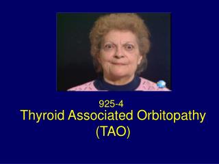 Thyroid Associated Orbitopathy (TAO)