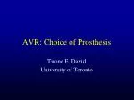AVR: Choice of Prosthesis - slide 1