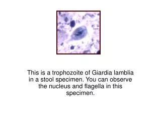 This is a trophozoite of Giardia lamblia in a stool specimen. You can observe the nucleus and flagella in this specimen.