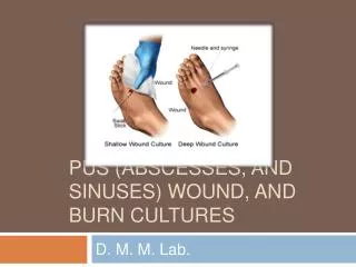 Pus (Abscesses, and sinuses) wound, and Burn Cultures