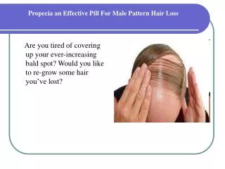 Propecia an Effective Pill For Male Pattern Hair Loss