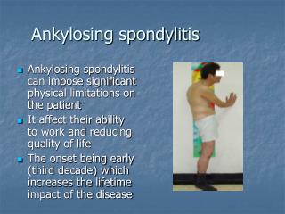 Ankylosing spondylitis