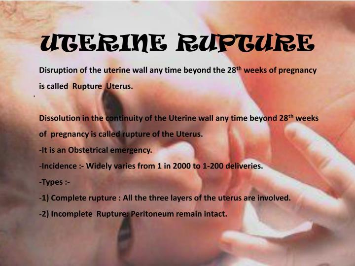 uterine rupture
