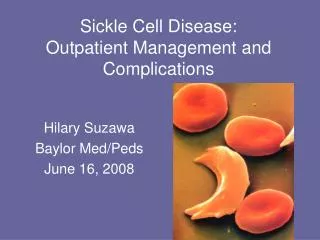 Sickle Cell Disease: Outpatient Management and Complications