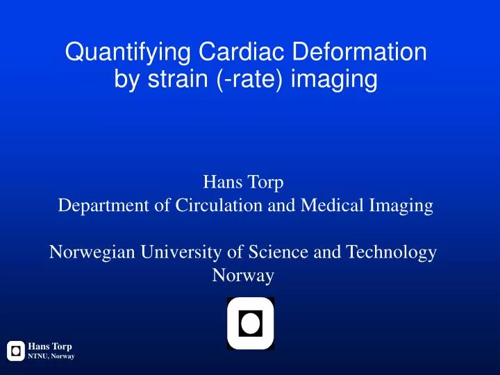 quantifying cardiac deformation by strain rate imaging