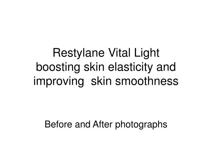 restylane vital light boosting skin elasticity and improving skin smoothness