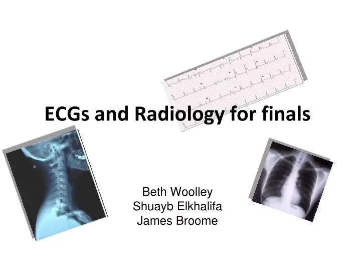 ecgs and radiology for finals beth woolley shuayb elkhalifa james broome