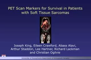 PET Scan Markers for Survival in Patients with Soft Tissue Sarcomas