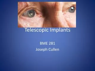Telescopic Implants