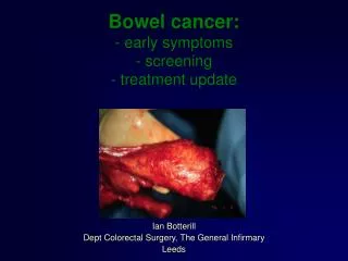 Bowel cancer: - early symptoms - screening - treatment update