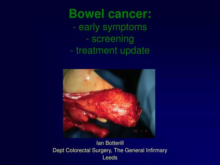 bowel cancer early symptoms screening treatment update
