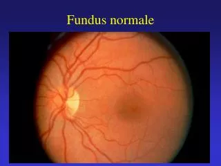 Fundus normale