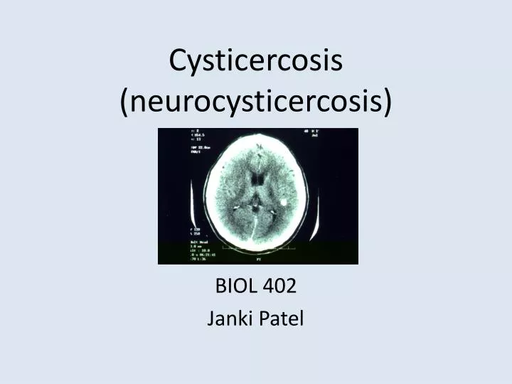 cysticercosis neurocysticercosis
