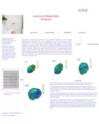 Analysis of Shaken Baby Syndrome