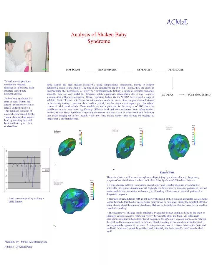analysis of shaken baby syndrome