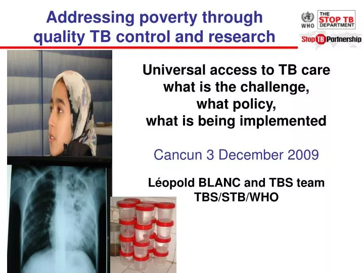 addressing poverty through quality tb control and research