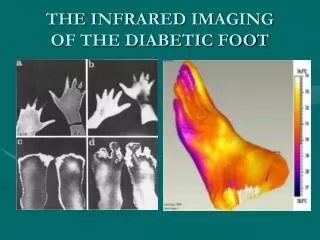 THE INFRARED IMAGING OF THE DIABETIC FOOT