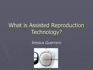 What is Assisted Reproduction Technology?