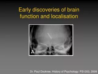 Early discoveries of brain function and localisation
