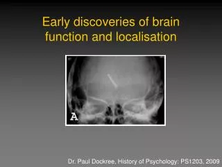 early discoveries of brain function and localisation