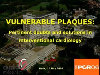 VULNERABLE PLAQUES: Pertinent d oubts and solutions in interventional cardiology