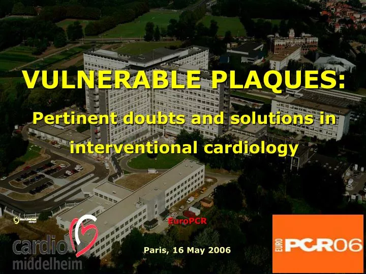 vulnerable plaques pertinent d oubts and solutions in interventional cardiology